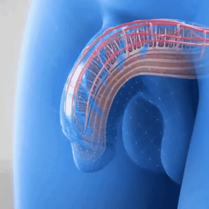 PlancherPelvien™ Pro – Renforcez votre routine de bien-être intime en toute discrétion